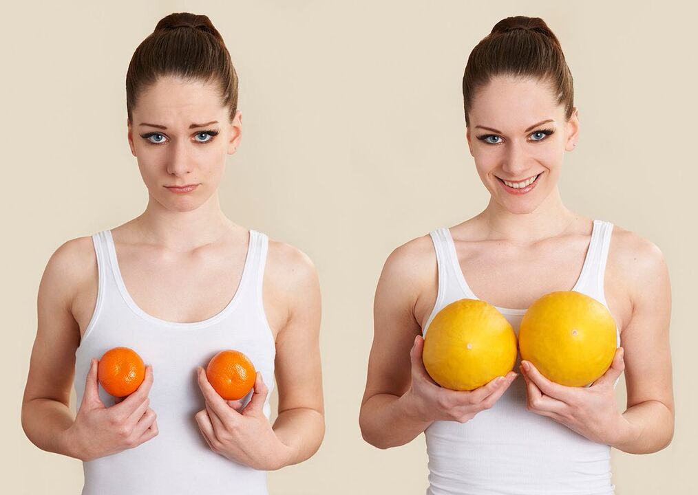Correction of the shape of the breast