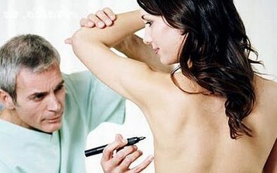Surgical method of breast augmentation