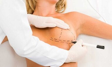 How to increase the cerebrals of implants
